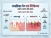 पायरिया रोग एवं चिकित्सा