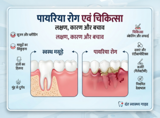 पायरिया रोग एवं चिकित्सा